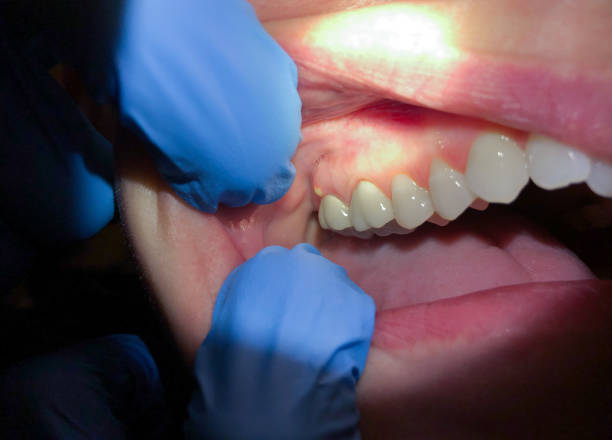 Best Knocked-Out Tooth Emergency  in Long Creek, IL