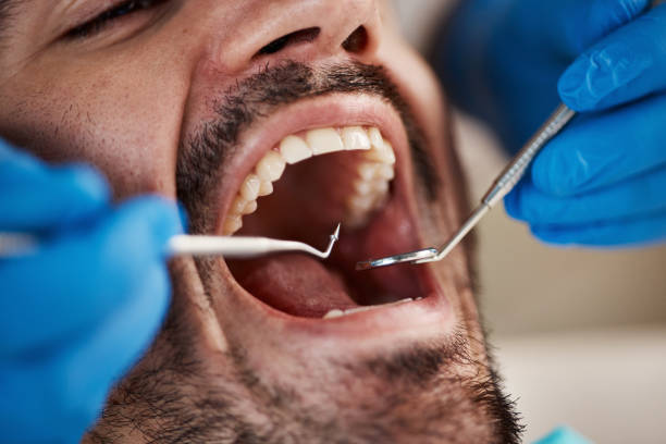 Best Dentist for Tooth Abscess  in Long Creek, IL