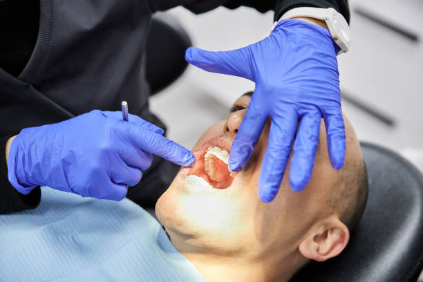 Best Dentist for Tooth Abscess  in Long Creek, IL